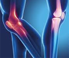 Кости и суставы