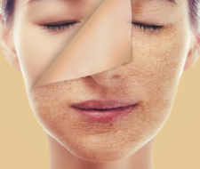 Кожа и волосы