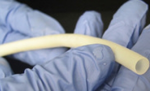 Впервые ученые имплантировали искусственный кровеносный сосуд человеку