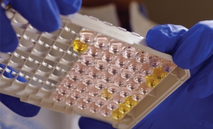 Разработано лекарство, эффективно вылечивающее гепатит C